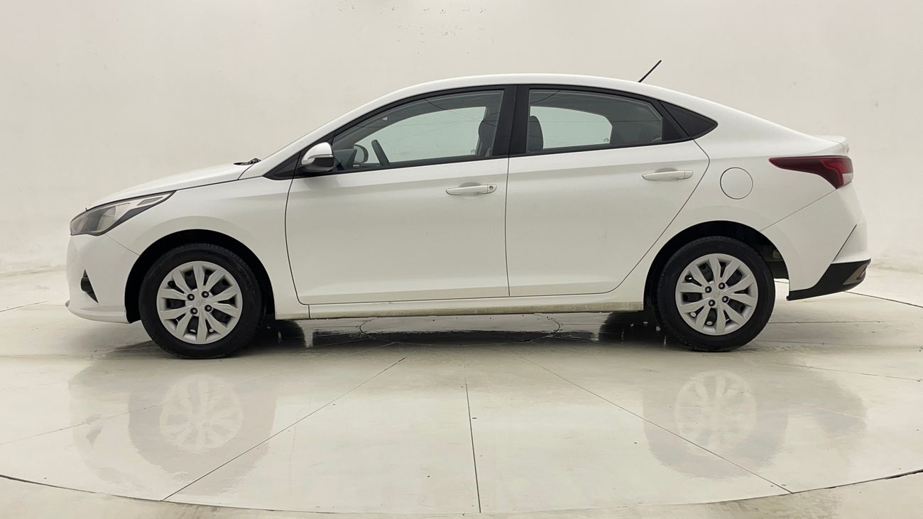 Hyundai Accent SMART 1.6 | Zero Down Payment | Home Test Drive