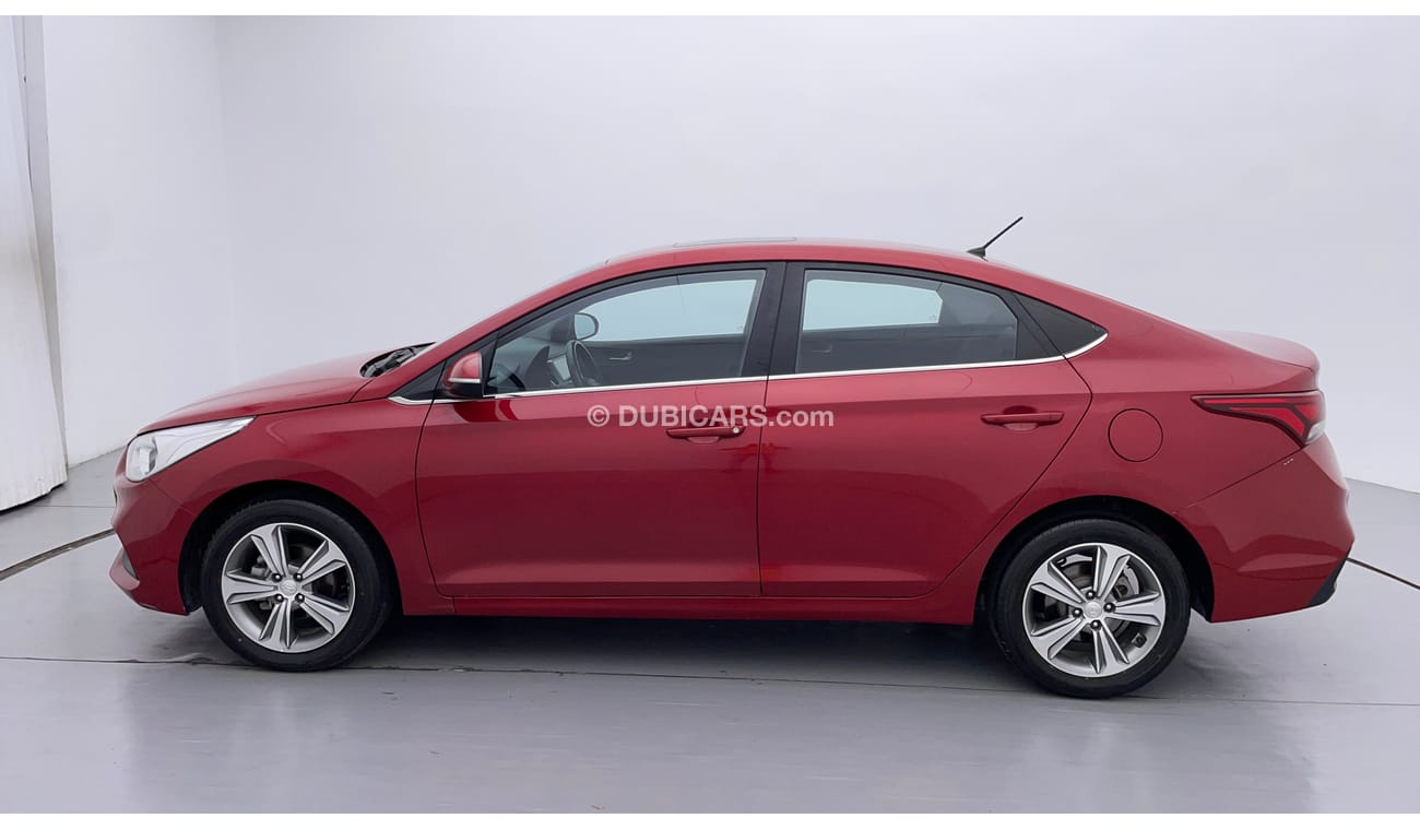 Hyundai Accent GLS 1.6 | Zero Down Payment | Free Home Test Drive