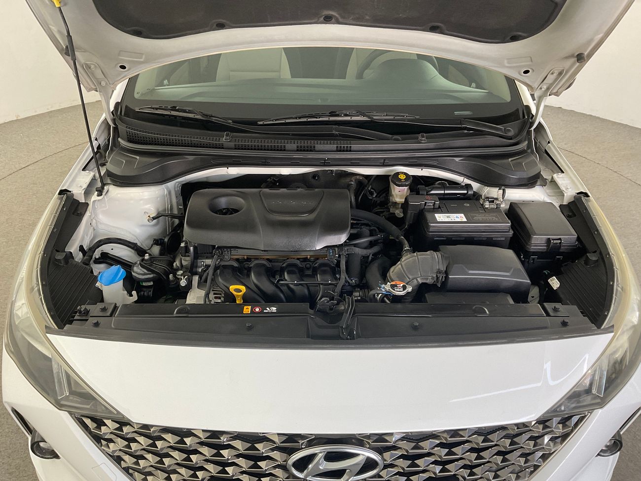 هيونداي أكسنت Smart / GL | شامل الضمان | 0 ﺪﻔﻋﺓ ﺃﻮﻟﻯ