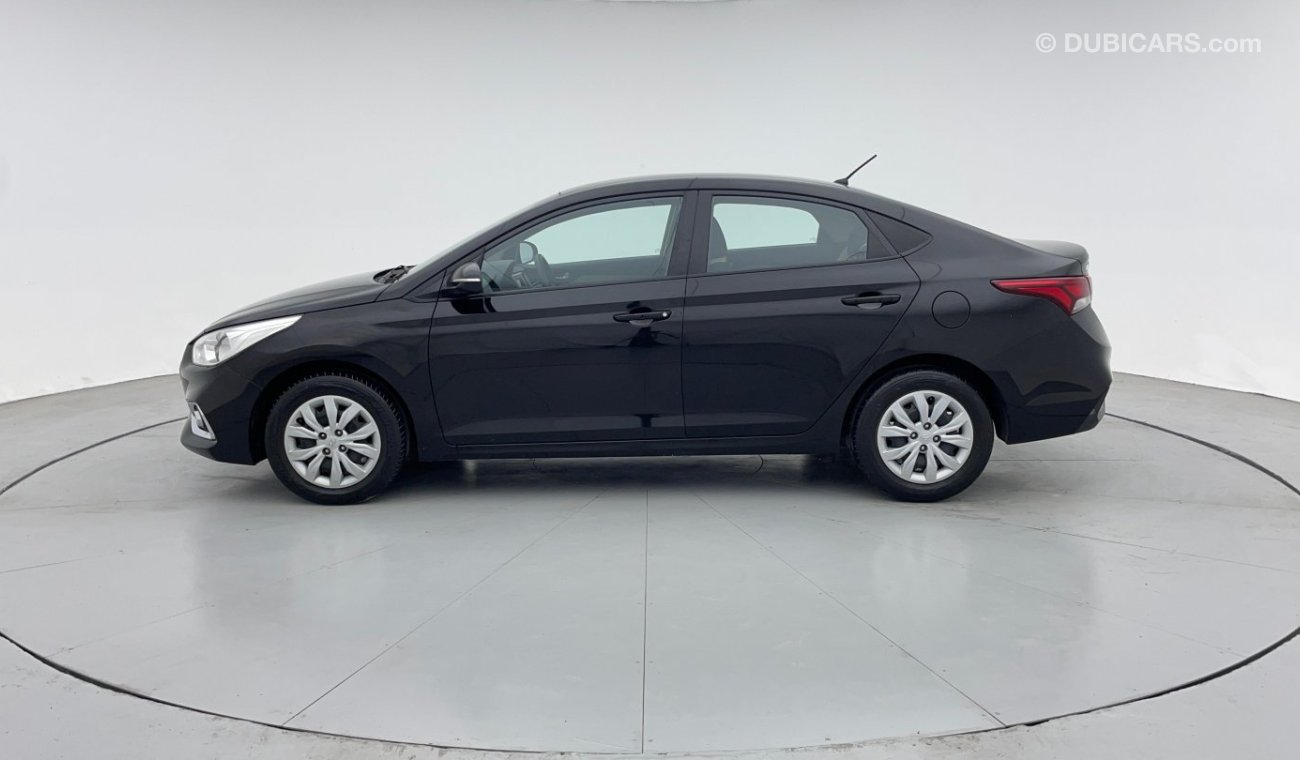 Hyundai Accent GL 1.6 | Zero Down Payment | Free Home Test Drive