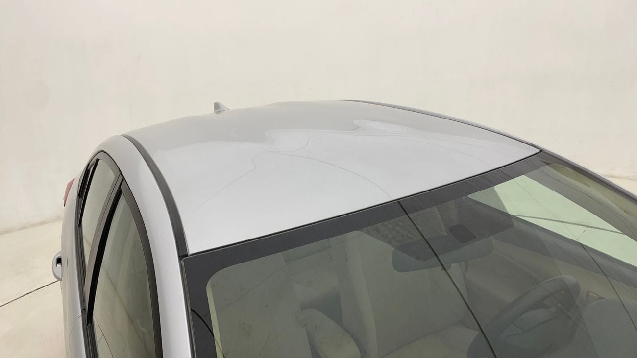 تويوتا يارس SE 1.5 | بدون دفعة مقدمة | اختبار القيادة في المنزل